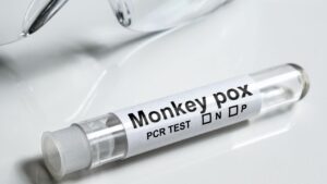 monkey pox